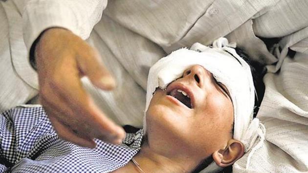A father comforts his son whom he said was injured by pellets shot by security forces in Srinagar on August 18, 2016. (Reuters) A father comforts his son whom he said was injured by pellets shot by security forces in Srinagar on August 18, 2016. (Reuters)