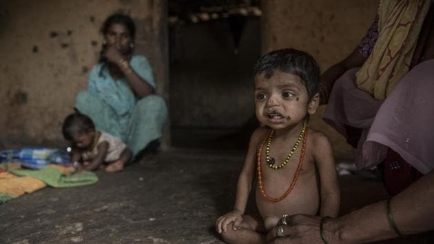 Every third malnourished child in the world is Indian. Every third child in India is malnourished. They deserve much better from their governments than escape paths to the central duty of a caring state to ensure adequate nutritious food in their bellies(Satish Bate/HT PHOTO)