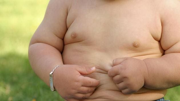 obesity in children