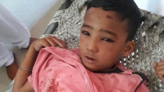 8-year-old Kartik was injured when the local Akali leader started firing at his brother’s house. (HT Photo) 8-year-old Kartik was injured when the local Akali leader started firing at his brother’s house. (HT Photo)