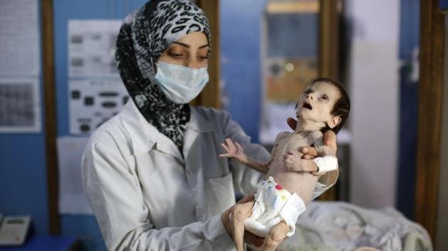 One-month-old Sahar, suffering from severe malnutrition, is carried by a nurse at a clinic in the rebel-controlled town of Hamouria, in the eastern Ghouta region on the outskirts of the capital Damascus. Sahar died on Sunday.(AFP)