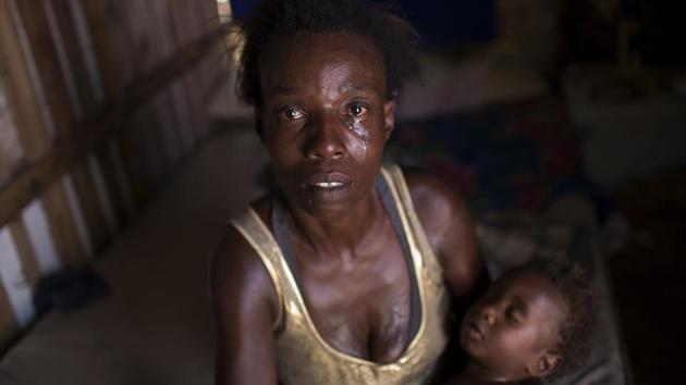 ‘Every day is a struggle to survive,’ 40-year-old Simone Batista said, recounting being cut from ‘Bolsa Familia’, a government subsidy program for low-income people in Brazil. Tens of millions of Brazilians emerged from poverty between 2004-14 as the country’s economy boomed, financing welfare programs that put money into the pockets of the poorest. But that trend has reversed over the last two years due to the deepest recession in Brazil’s history and cuts to its subsidy programs. (Silvia Izquierdo / AP)