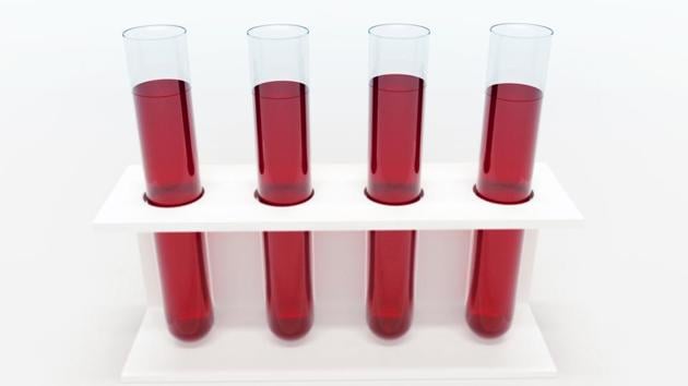 The finding is important because patients who misuse alcohol tend to have worse outcomes. (Shutterstock) The finding is important because patients who misuse alcohol tend to have worse outcomes. (Shutterstock)