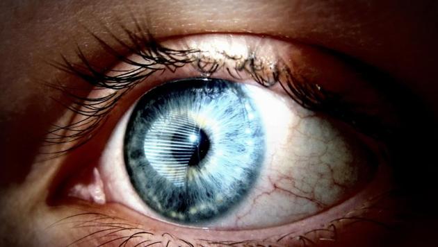 Patients in the study had a condition called Leber congenital amaurosis (LCA), which begins in infancy and progresses slowly, eventually causing complete blindness. There are currently no treatments available for inherited retinal diseases. (Shutterstock) Patients in the study had a condition called Leber congenital amaurosis (LCA), which begins in infancy and progresses slowly, eventually causing complete blindness. There are currently no treatments available for inherited retinal diseases. (Shutterstock)