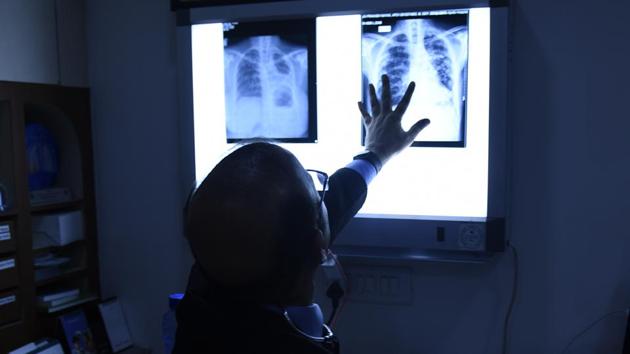 Dr. Rajesh Chawla, a pulmonologist and respiratory medicine consultant says that asthma cases have shot up in the city and his ‘by-appointment’ only clinic has turned into a ‘walk-in’ situation this week. (Sanchit Khanna / HT Photo) Dr. Rajesh Chawla, a pulmonologist and respiratory medicine consultant says that asthma cases have shot up in the city and his ‘by-appointment’ only clinic has turned into a ‘walk-in’ situation this week. (Sanchit Khanna / HT Photo)