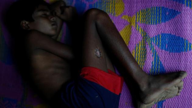Rohingya refugee Ansar Allah, 11, poses for a photograph at Leda refugee camp in Bangladesh. Rights monitors and fleeing Rohingya say the army and Rakhine Buddhist vigilantes have mounted a campaign of arson aimed at driving out the Muslim population. (Jorge Silva / REUTERS) Rohingya refugee Ansar Allah, 11, poses for a photograph at Leda refugee camp in Bangladesh. Rights monitors and fleeing Rohingya say the army and Rakhine Buddhist vigilantes have mounted a campaign of arson aimed at driving out the Muslim population. (Jorge Silva / REUTERS)