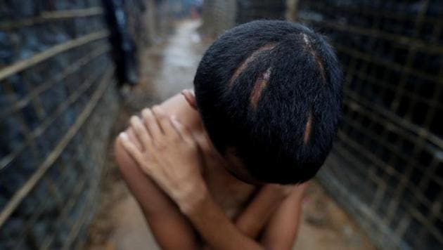Nur Kamal, 17, poses for a photograph showing head injuries, at Kutupalang refugee camp, near Cox's Bazar in Bangladesh.Since ethnic violence erupted in Myanmar, thousands of Rohingya have crossed the border, often travelling for days and even weeks, making a hazardous river or sea crossing on the last leg of their flight to Bangladesh. (Jorge Silva / REUTERS) Nur Kamal, 17, poses for a photograph showing head injuries, at Kutupalang refugee camp, near Cox's Bazar in Bangladesh.Since ethnic violence erupted in Myanmar, thousands of Rohingya have crossed the border, often travelling for days and even weeks, making a hazardous river or sea crossing on the last leg of their flight to Bangladesh. (Jorge Silva / REUTERS)