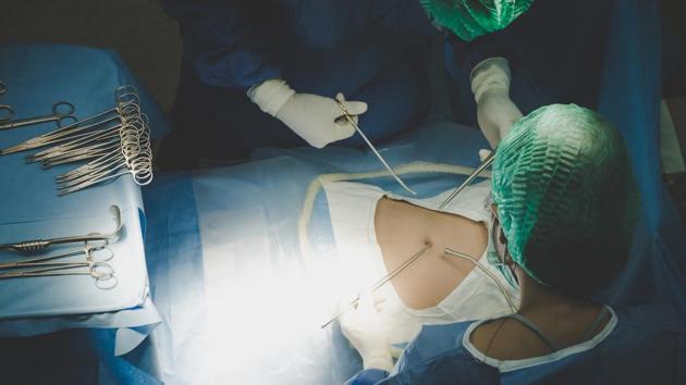 The surgery was conducted by a five-member team of doctors on Monday. (Representative image) The surgery was conducted by a five-member team of doctors on Monday. (Representative image)