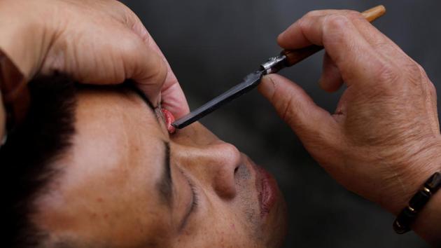 Xiong Gaowu, cleans a customer’s eye using his traditional technique. While customers insist their eyes felt better after a shave, onlookers cringe at the sight of Xiong wielding a razor so close to the eye. “I am afraid to do it,” said He Yiting, 27, who winced as she watched Xiong attend to a customer. (Tyrone Siu / REUTERS) Xiong Gaowu, cleans a customer’s eye using his traditional technique. While customers insist their eyes felt better after a shave, onlookers cringe at the sight of Xiong wielding a razor so close to the eye. “I am afraid to do it,” said He Yiting, 27, who winced as she watched Xiong attend to a customer. (Tyrone Siu / REUTERS)