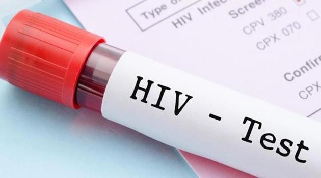 Many people with HIV also experience negative cognitive symptoms, such as depression and forgetfulness.(Shutterstock)