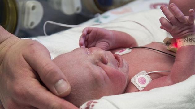 The first baby born as a result of a womb transplant in the United States lies in the neonatal unit at Baylor University Medical Center in Dallas, the USA. (AP Photo) The first baby born as a result of a womb transplant in the United States lies in the neonatal unit at Baylor University Medical Center in Dallas, the USA. (AP Photo)