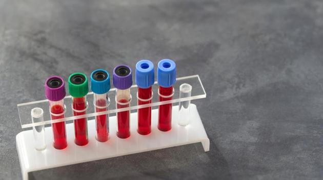 A negative result means a 98% chance that you would not have a recurrence in the next two years and could skip further treatment. (Shutterstock) A negative result means a 98% chance that you would not have a recurrence in the next two years and could skip further treatment. (Shutterstock)