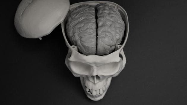 Traumatic brain injury (TBI) can cause gut dysfunction.(Shutterstock) Traumatic brain injury (TBI) can cause gut dysfunction.(Shutterstock)