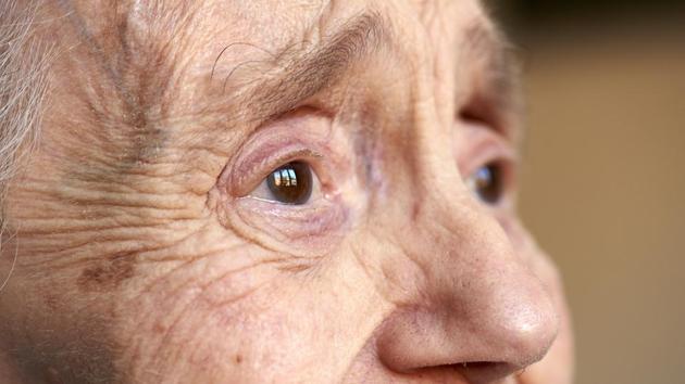 Their previous study revealing that urea is similarly linked to Alzheimer’s, shows that the discovery could be relevant to all types of age-related dementias. (Shutterstock) Their previous study revealing that urea is similarly linked to Alzheimer’s, shows that the discovery could be relevant to all types of age-related dementias. (Shutterstock)