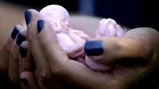 India recorded around 15.6 million abortions in 2015, reports the study published in The Lancet.(File Photo) India recorded around 15.6 million abortions in 2015, reports the study published in The Lancet.(File Photo)