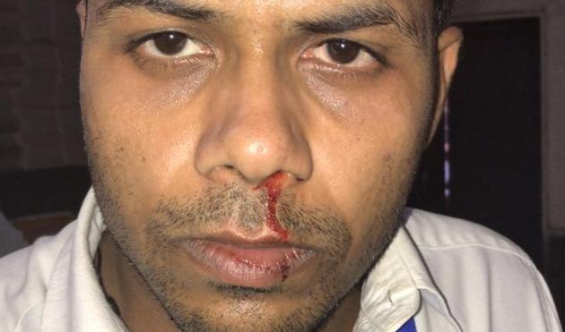 Ticket checker Dhananjay Kumar alleges he was punched in the face by constable Vilas Jagannath Pawar. Ticket checker Dhananjay Kumar alleges he was punched in the face by constable Vilas Jagannath Pawar.