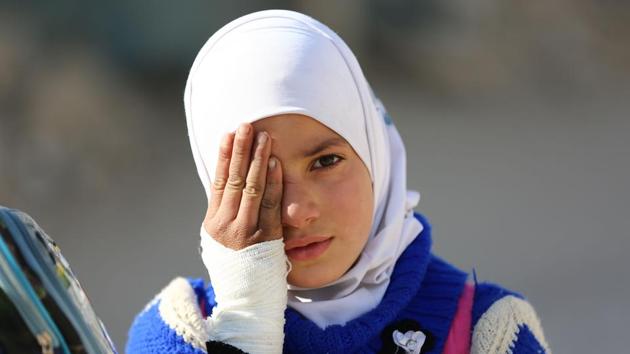A girl covers one eye with her hand in the rebel-held town of Douma in Syria's besieged eastern Ghouta region on December 18, 2017, as part of a campaign in solidarity with a baby boy, Karim Abdallah, who lost an eye, as well as his mother, in government shelling on the nearby town of Hammouria. (#SolidarityWithKarim campaign / AFP) A girl covers one eye with her hand in the rebel-held town of Douma in Syria's besieged eastern Ghouta region on December 18, 2017, as part of a campaign in solidarity with a baby boy, Karim Abdallah, who lost an eye, as well as his mother, in government shelling on the nearby town of Hammouria. (#SolidarityWithKarim campaign / AFP)