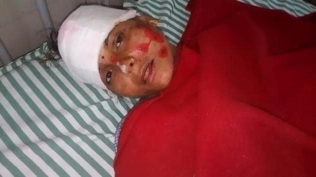 Kamlesh devi, one of the survivors from the bus accident, at a private hospital in Sawai Madhopur on Saturday. (VIDEO GRAB) Kamlesh devi, one of the survivors from the bus accident, at a private hospital in Sawai Madhopur on Saturday. (VIDEO GRAB)