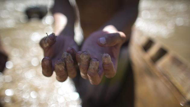 A river scavenger shows fingers wrapped with scotch tape, as he digs for valuables. Scavengers say they often cut their fingers on the river’s jagged bottom and their fingers get infected. Calls to clean up the river and millions already spent have had no result on its health. (Ariana Cubillos / AP) A river scavenger shows fingers wrapped with scotch tape, as he digs for valuables. Scavengers say they often cut their fingers on the river’s jagged bottom and their fingers get infected. Calls to clean up the river and millions already spent have had no result on its health. (Ariana Cubillos / AP)