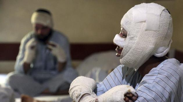 Mohammad Ali, 21, receives treatment at a hospital in Kabul. The Islamic State group in Afghanistan, which calls itself the Khorasan Province, views Shiite Muslims as apostates and has repeatedly attacked the minority and targets linked to neighbouring Iran. (Rahmat Gul / AP) 