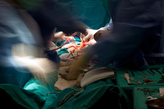 Three more lives were saved in different transplant surgeries that took place in Mumbai and Chennai.(Pic for representation/Getty Images)