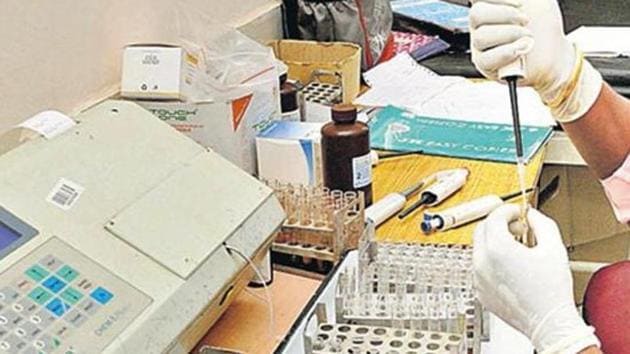 The municipal corporation will give contracts of diagnostic tests to private bidders for public hospitals.(HT FILE)