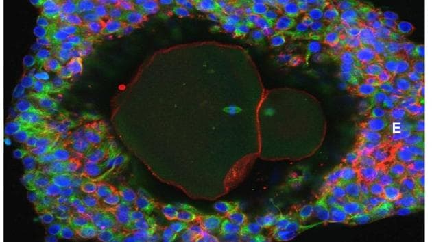 An undated picture shows a magnification of a lab-grown fully matured human egg ready for fertilisation. (Reuters) An undated picture shows a magnification of a lab-grown fully matured human egg ready for fertilisation. (Reuters)