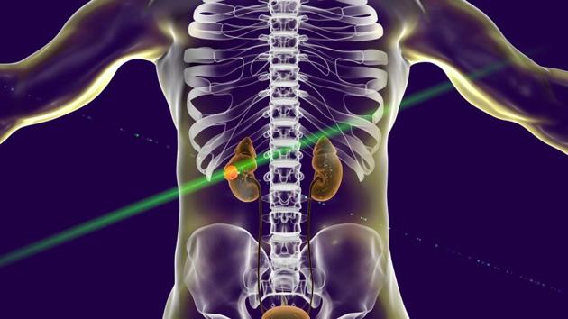 The immunotherapy agent, pembrolizumab, is an immune checkpoint inhibitor that blocks a self-defence mechanism used by cancer cells to evade attack and destruction by the body’s immune cells. (Shutterstock) The immunotherapy agent, pembrolizumab, is an immune checkpoint inhibitor that blocks a self-defence mechanism used by cancer cells to evade attack and destruction by the body’s immune cells. (Shutterstock)