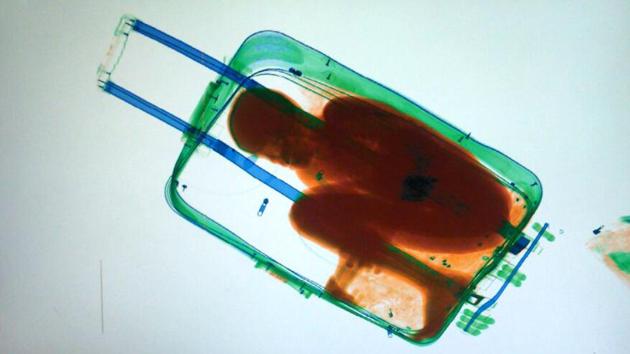 A 2015 image shows an X-ray image showing 8-year-old Ivorian boy Adou Ouattara hidden in a suitcase. (AFP File Photo) A 2015 image shows an X-ray image showing 8-year-old Ivorian boy Adou Ouattara hidden in a suitcase. (AFP File Photo)