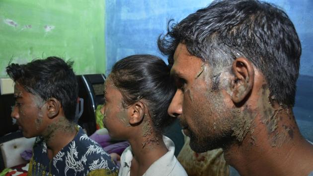 Doctors said the three patients had superficial burns on their face and neck, the kind that is caused by a corrosive liquid.(Sakib Ali/HT Photo)