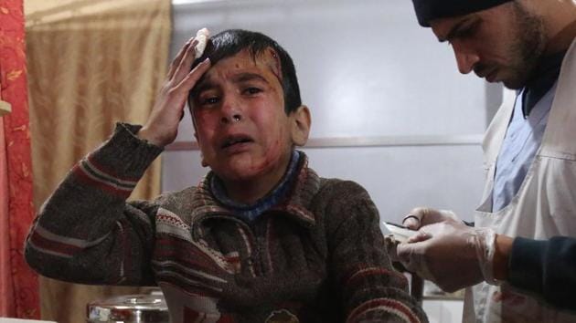 Ghaith, a wounded 12-year-old Syrian boy, cries as he receives treatment at a make-shift hospital in Kafr Batna in the besieged Eastern Ghouta region. (AFP Photo) Ghaith, a wounded 12-year-old Syrian boy, cries as he receives treatment at a make-shift hospital in Kafr Batna in the besieged Eastern Ghouta region. (AFP Photo)