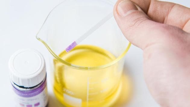 Researchers, including those from Sichuan University in China, found that a substance indicating oxidative damage increases in urine as people get older. (Shutterstock) Researchers, including those from Sichuan University in China, found that a substance indicating oxidative damage increases in urine as people get older. (Shutterstock)