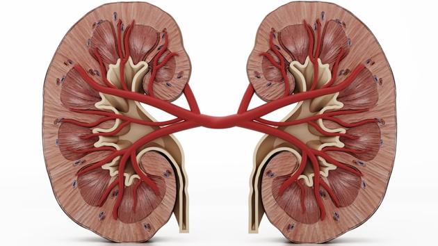 Chronic kidney disease (CKD) affects 15-20 % of India’s adult population and is one of the top 20 causes of death worldwide. (Getty Images/iStockphoto) Chronic kidney disease (CKD) affects 15-20 % of India’s adult population and is one of the top 20 causes of death worldwide. (Getty Images/iStockphoto)