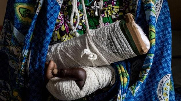 Alphonsime Mojetha, 54, recovers in a hospital room in Bunia, after an attack on her village where she lost her children, and received severe lacerations to her head, arms and hands from a machete attack. The assailants came in waves. First came the ones who killed. Then those who torched homes. And finally, the ones who looted anything of value. Ahead of them, terrorised villagers fled for their lives. (John Wessels / AFP) Alphonsime Mojetha, 54, recovers in a hospital room in Bunia, after an attack on her village where she lost her children, and received severe lacerations to her head, arms and hands from a machete attack. The assailants came in waves. First came the ones who killed. Then those who torched homes. And finally, the ones who looted anything of value. Ahead of them, terrorised villagers fled for their lives. (John Wessels / AFP)