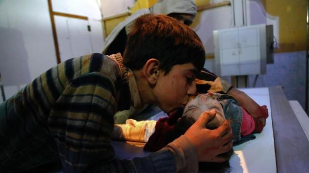 A boy kisses his relative who was wounded in government shelling in the radiography room of a hospital in Douma, in the besieged rebel-held enclave of Eastern Ghouta. (Hasan Mohamed / AFP) A boy kisses his relative who was wounded in government shelling in the radiography room of a hospital in Douma, in the besieged rebel-held enclave of Eastern Ghouta. (Hasan Mohamed / AFP)