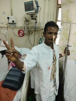 Salim Shaikh, the 33-year-old labourer from Nashik, after his surgery. Salim Shaikh, the 33-year-old labourer from Nashik, after his surgery.