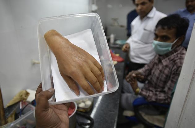 Aided by 3-D printing technology, a private firm in India is making high-tech customised prosthetics for amputees at half the price of imported ones that cost upwards of ₹1.5 lakh. Offering an alternative to imported prosthetic hands, the company is also launching an indigenously developed myoelectric prosthetic hand with thumb rotation and functions such as gripping objects. (Raj K Raj / HT Photo) Aided by 3-D printing technology, a private firm in India is making high-tech customised prosthetics for amputees at half the price of imported ones that cost upwards of ₹1.5 lakh. Offering an alternative to imported prosthetic hands, the company is also launching an indigenously developed myoelectric prosthetic hand with thumb rotation and functions such as gripping objects. (Raj K Raj / HT Photo)