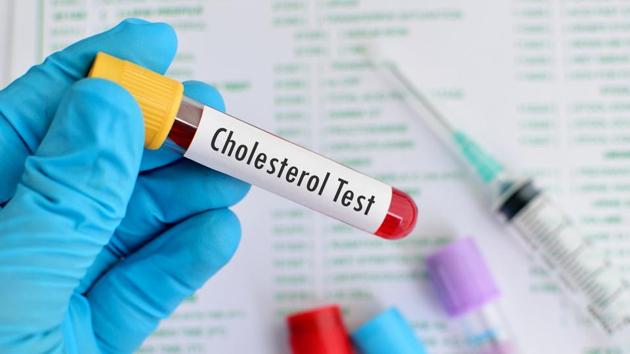 Individuals with very low high-density lipoproteins (HDL) cholesterol, also called good cholesterol, had a 75% higher risk of infectious disease, whereas the risk was 43% higher in those with very high HDL cholesterol.(Getty Images/iStockphoto)