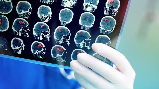 Doctors so far have been constrained to view CT/MRI scan images only in two dimensions on computer screens.(Shutterstock)