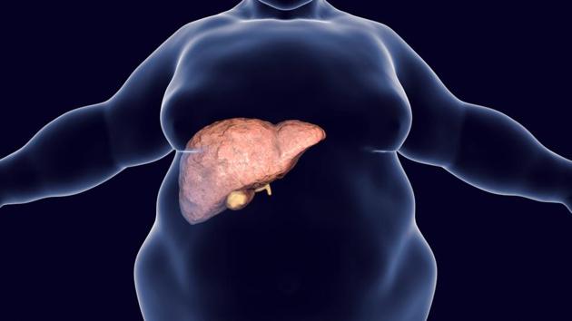 alcoholic human liver