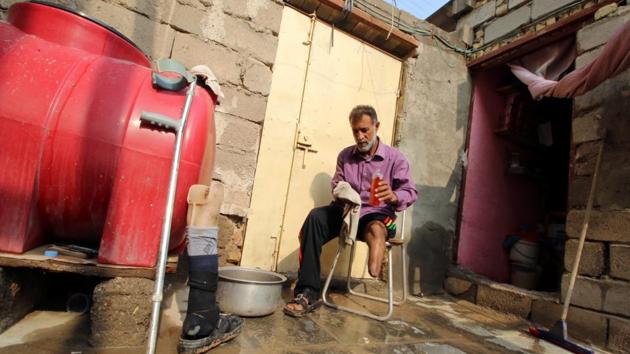 A man disabled by a landmine explosion cleans and disinfects his truncated leg. “I was out (in the field) to seek my living from God, collecting iron and copper; the kilogram of flour had become so expensive,” said Falih, who lost a leg and five finger tips in an explosion. (Essam Al-Sudani / REUTERS) 