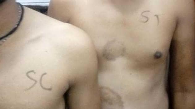 Candidates with ‘SC’ and ‘ST’ marked on their chests seen during a medical examination in Dhar, Madhya Pradesh. (HT Photo) Candidates with ‘SC’ and ‘ST’ marked on their chests seen during a medical examination in Dhar, Madhya Pradesh. (HT Photo)
