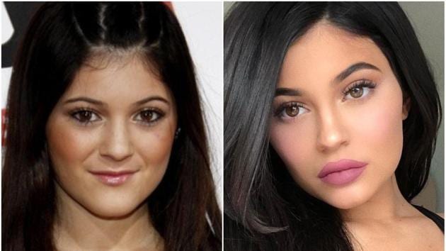 Kylie Jenner reveals how insecurity made her change her lips, start a ...