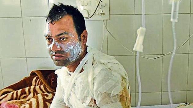 Harjeet Singh Bedi, 33, sustained 40% burn injuries and has been admitted to the civil hospital. (Gurpreet Singh/HT) Harjeet Singh Bedi, 33, sustained 40% burn injuries and has been admitted to the civil hospital. (Gurpreet Singh/HT)