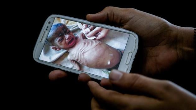 A doctor shows a photo of Fadl, an 8-month-old boy, taken in his last days before he starved to death. Fadl’s mother gave birth to him under a tree as she fled fighting, and ever since she struggled to get him enough food. When asked about her diet, Fadl’s mother replied, “Bor,” the local Arabic word for flour. (Nariman El-Mofty / AP) A doctor shows a photo of Fadl, an 8-month-old boy, taken in his last days before he starved to death. Fadl’s mother gave birth to him under a tree as she fled fighting, and ever since she struggled to get him enough food. When asked about her diet, Fadl’s mother replied, “Bor,” the local Arabic word for flour. (Nariman El-Mofty / AP)