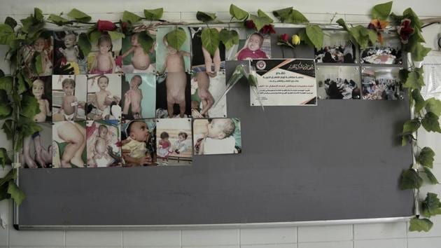 Photographs of severely malnourished infants are seen on a wall at the Aden Hospital. Coalition warplanes have blasted hospitals, schools, farms, factories, bridges and roads. Even before the war, the Arab world’s poorest nation struggled to feed itself. It is a country of deserts and mountains where only 2 to 4% of the land is cultivated and therefore almost all food and supplies must be imported. (Nariman El-Mofty / AP) Photographs of severely malnourished infants are seen on a wall at the Aden Hospital. Coalition warplanes have blasted hospitals, schools, farms, factories, bridges and roads. Even before the war, the Arab world’s poorest nation struggled to feed itself. It is a country of deserts and mountains where only 2 to 4% of the land is cultivated and therefore almost all food and supplies must be imported. (Nariman El-Mofty / AP)