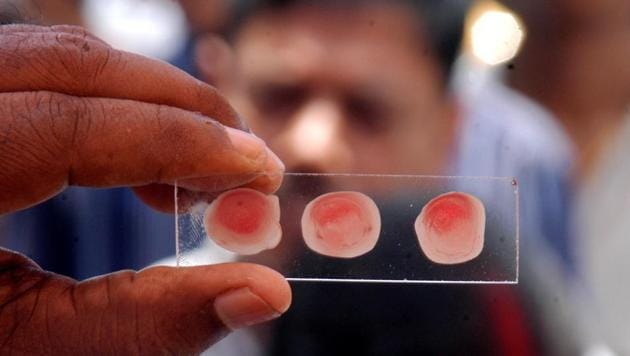 Blood tests for the RTI applicant showed he has two blood types — B positive and B negative.(HT/Photo for representation)