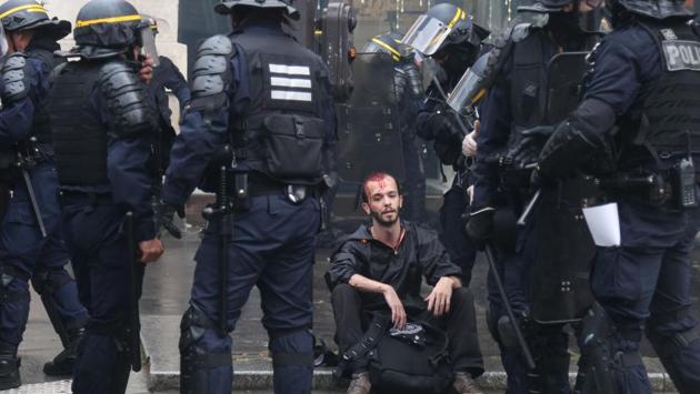 A wounded demonstrator is surrounded by riot police officers, in Paris, during a nationwide day protest by French public sector employees and public servants against the overhauls proposed by French President Macron, calling them an "attack" by the centrist leader against civil services as well as their economic security. (Zakaria Abdelkafi / AFP)