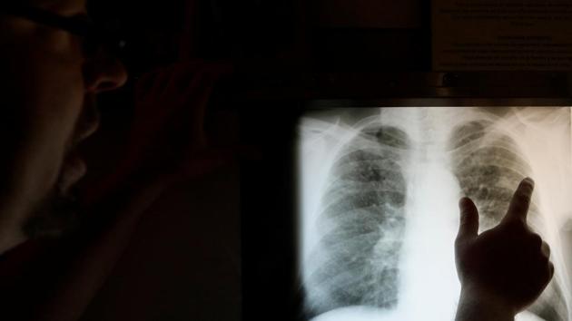 The coal industry, meanwhile, is lobbying to ensure the tax reduction goes forward. “More often than not, we are being called upon to provide compensation for previous or current smokers,” said Bruce Watzman, head of regulatory affairs for the National Mining Association. Medical experts dispute this argument, saying the disease - an incurable illness caused by inhaling coal dust - is easy to distinguish with X-rays. (Brian Snyder / REUTERS) The coal industry, meanwhile, is lobbying to ensure the tax reduction goes forward. “More often than not, we are being called upon to provide compensation for previous or current smokers,” said Bruce Watzman, head of regulatory affairs for the National Mining Association. Medical experts dispute this argument, saying the disease - an incurable illness caused by inhaling coal dust - is easy to distinguish with X-rays. (Brian Snyder / REUTERS)