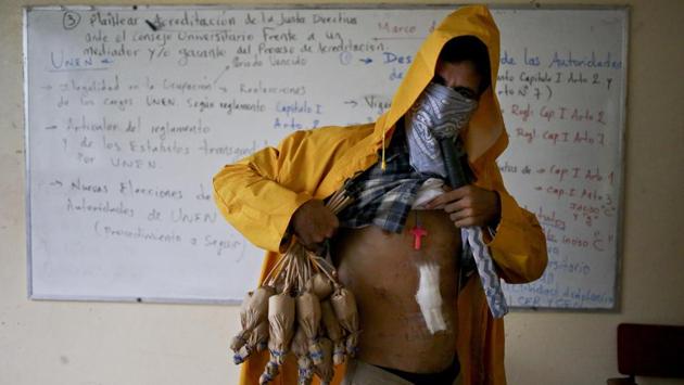 A university student hiding his identity shows a wound he says he got when he was shot by government security forces during a protest, inside the Autonomous University of Nicaragua. The brown paper packages hanging from his hand are homemade explosives. (Esteban Felix / AP)